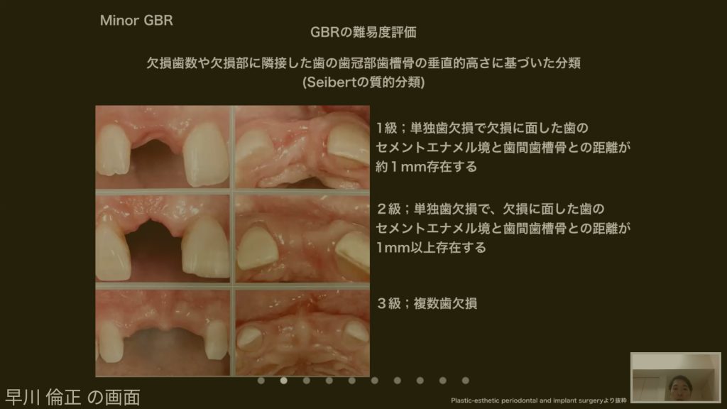 症例発表