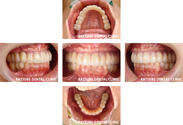 Case6